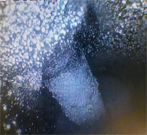 黑不溜秋的還有粉末狀，好惡心~  